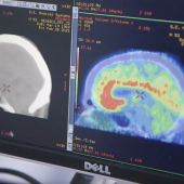 Voir la vidéo de Comprendre le stress post-traumatique